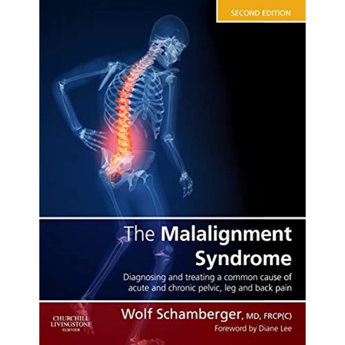 The Malalignment Syndrome-2E