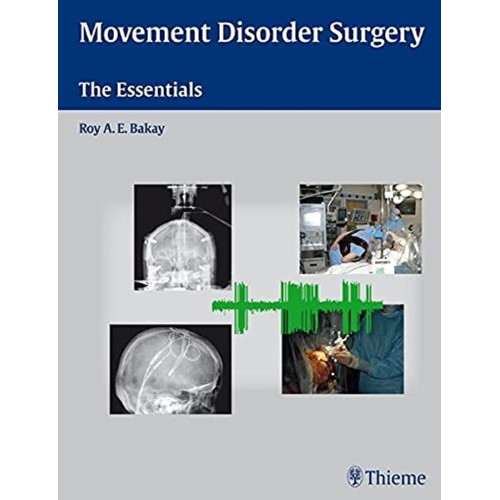 Movement Disorder Surgery