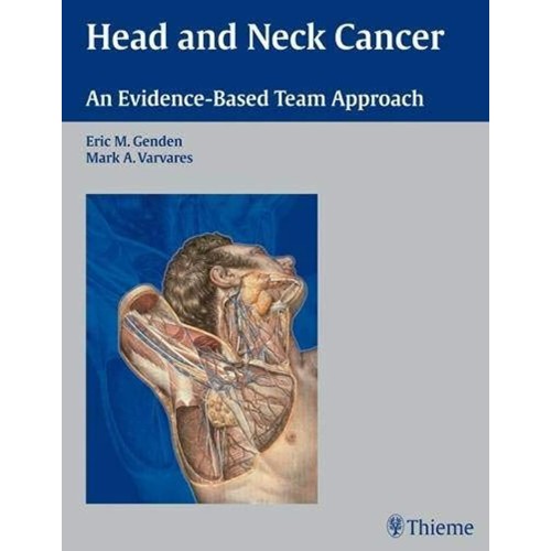 Head and Neck Cancer