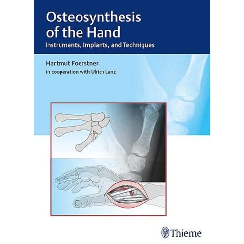 Osteosynthesis of the Hand : Instruments, Implants, and Techniques 1st Edition