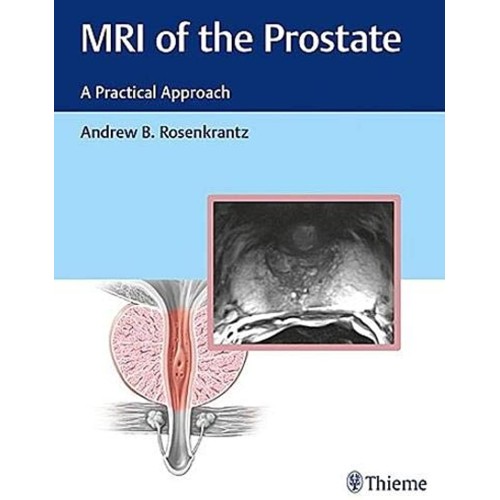 MRI of the Prostate A Practical Approach 1st ...