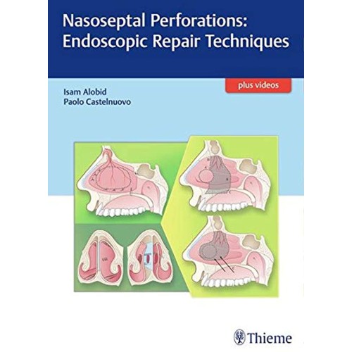 Nasoseptal Perforations: Endoscopic Repair Techniques 1st Edition