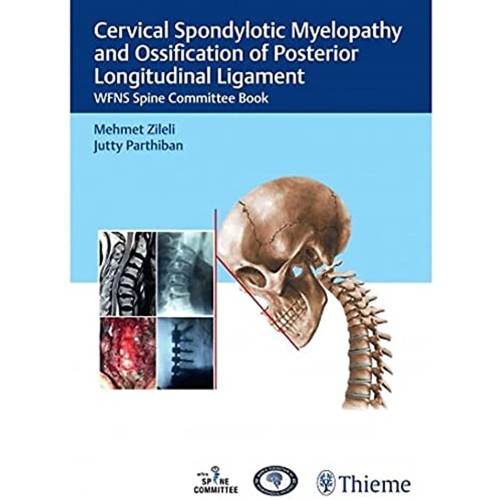 Cervical Spondylotic Myelopathy and OPLL 1st ...