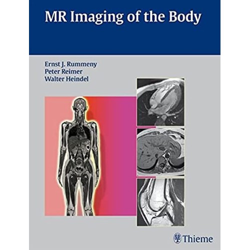 MR Imaging of the Body 1st Edition