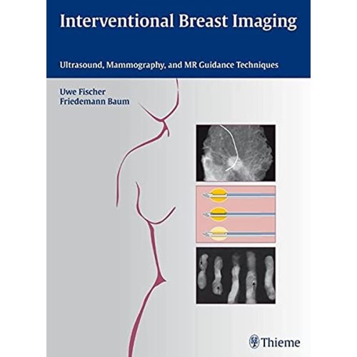 Interventional Breast Imaging