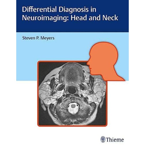 Differential Diagnosis in Neuroimaging Head a...