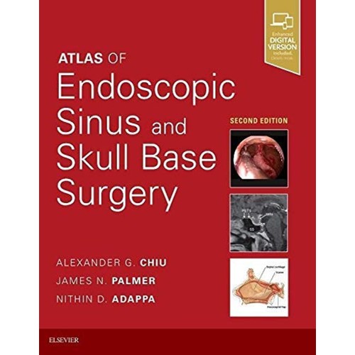 Atlas of Endoscopic Sinus and Skull Base Surgery: Expert Consult - Online and Print - 2E