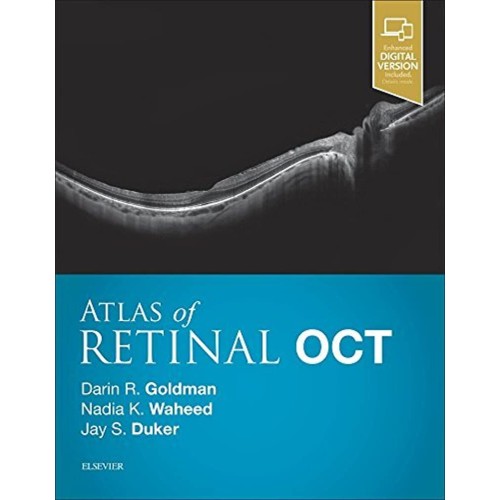 Atlas of Retinal OCT: Optical Coherence Tomog...
