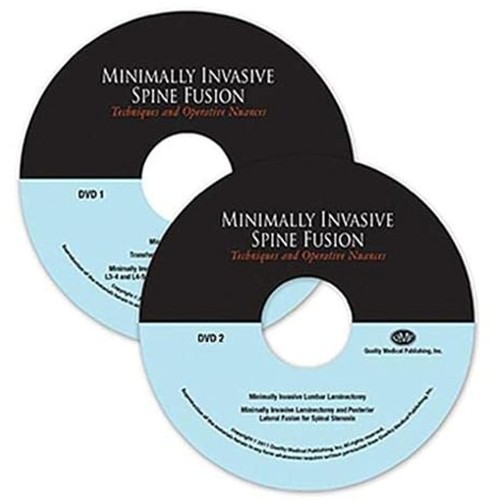 Minimally Invasive Spine Fusion: Techniques a...