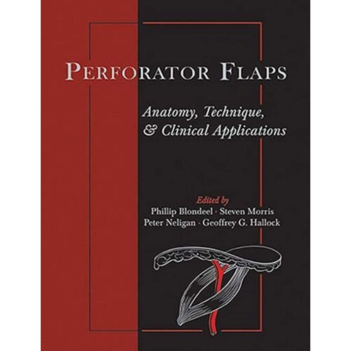 Perforator Flaps: Anatomy, Technique, & Clini...