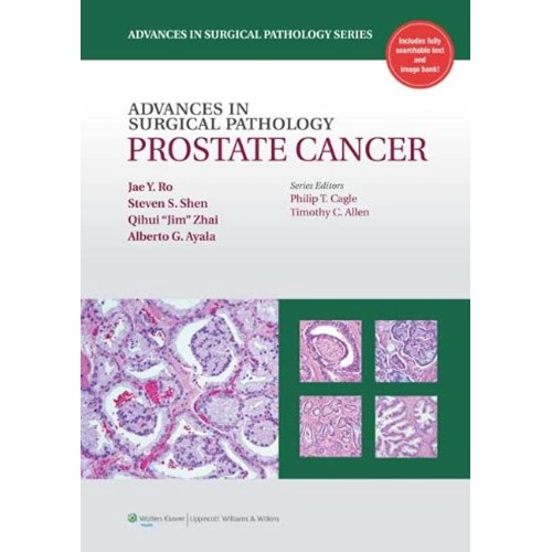 Advances in Surgical Pathology: Prostate Canc...