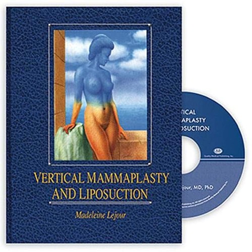 Vertical Mammaplasty and Liposuction 1st Edit...