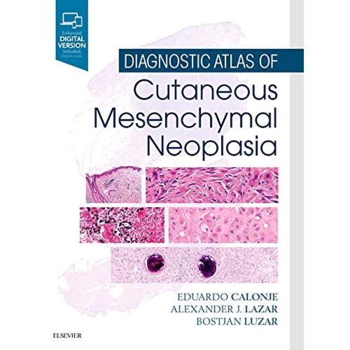 Diagnostic Atlas of Cutaneous Mesenchymal Neoplasia -1E