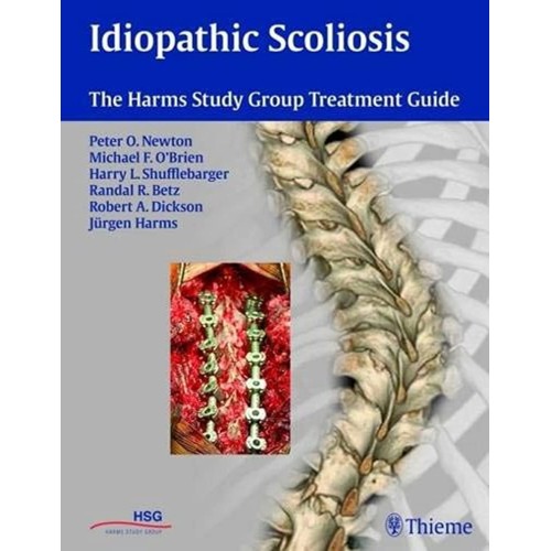 Idiopathic Scoliosis