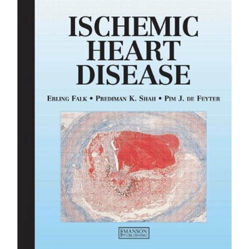 Ischaemic Heart Disease