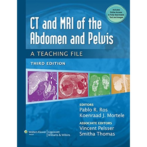 CT & MRI of the Abdomen and Pelvis: A Teachin...