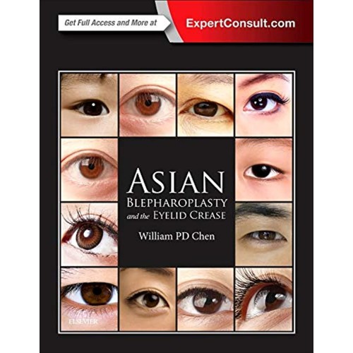 Asian Blepharoplasty and the Eyelid Crease: E...