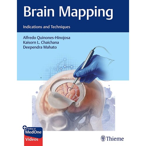 Brain Mapping : Indications and Techniques 1s...