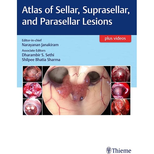 Atlas of Sellar, Suprasellar, and Parasellar ...