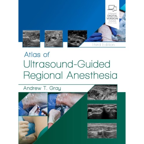 Atlas of Ultrasound-Guided Regional Anesthesi...