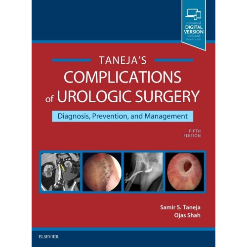 Complications of Urologic Surgery: Prevention and Management - 5E