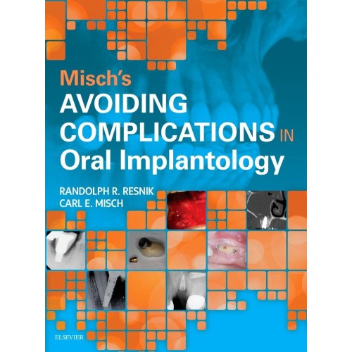 Avoiding Complications in Oral Implantology -...