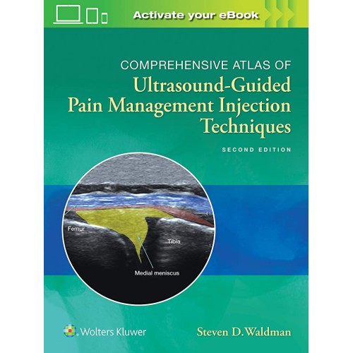 Comprehensive Atlas of Ultrasound-Guided Pain Management Injection Techniques - 2E