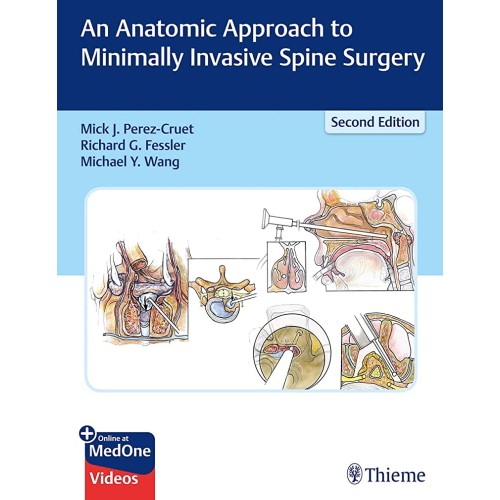 An Anatomic Approach to Minimally Invasive Sp...