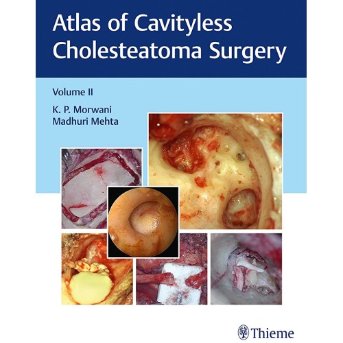 Atlas of Cavityless Cholesteatoma Surgery (Vo...