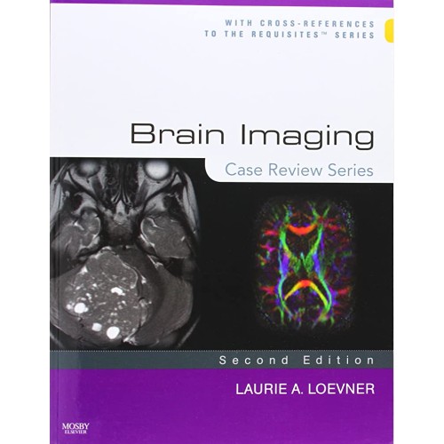 Brain Imaging- Case Review Series-2E