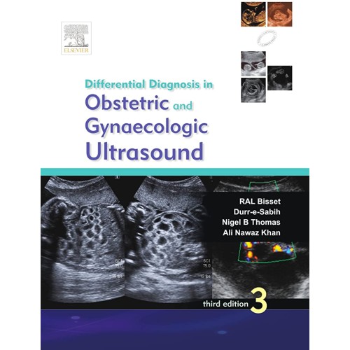 Differential Diagnosis in Obstetrics and Gyna...