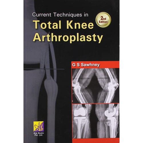 Current Techniques in Total Knee Arthroscopy ...