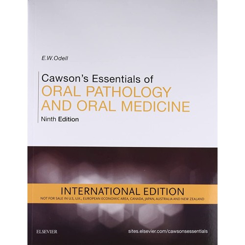 Cawson's Essentials of Oral Pathology and Ora...